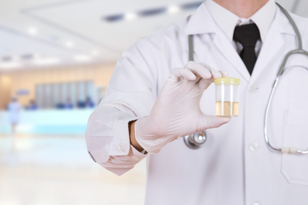 What Employers Should Know About Workplace Drug Testing