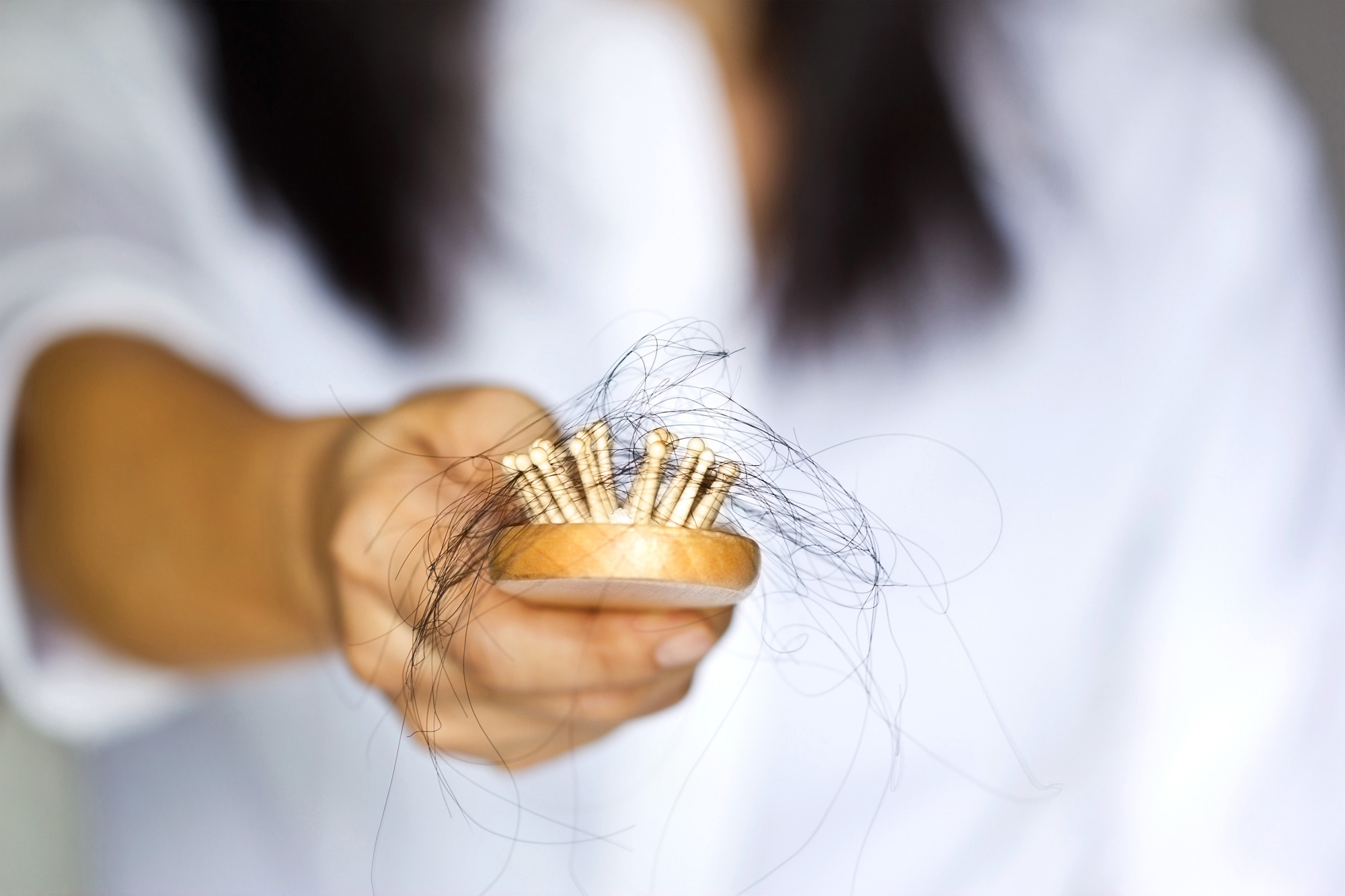 hair loss remedies