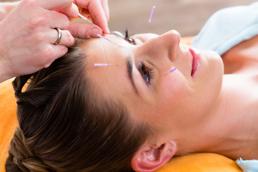 4 Signs You Should Visit an Acupuncture Clinic