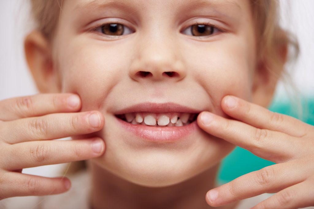 12 Tips On Preventing Cavities In Children