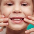 cavities in children